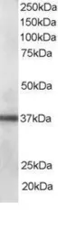 Anti-PDLIM1 antibody, C-term used in Western Blot (WB). GTX17022