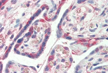 Anti-PDLIM1 antibody, C-term used in IHC (Paraffin sections) (IHC-P). GTX17022