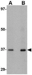 Anti-AIPL1 antibody used in Western Blot (WB). GTX17024