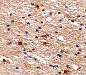 Anti-AIPL1 antibody used in IHC (Paraffin sections) (IHC-P). GTX17024