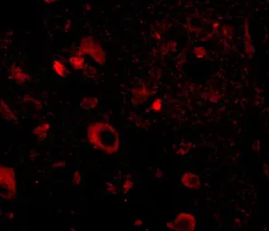 Anti-AIPL1 antibody used in IHC (Paraffin sections) (IHC-P). GTX17024