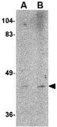 Anti-LASS6 antibody used in Western Blot (WB). GTX17028