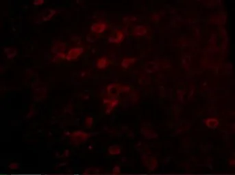 Anti-LASS6 antibody used in IHC (Paraffin sections) (IHC-P). GTX17028
