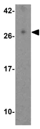Anti-EBI3 antibody used in Western Blot (WB). GTX17030