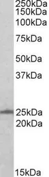 Anti-RAN antibody, N-term used in Western Blot (WB). GTX17033