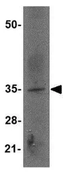 Anti-EBI3 antibody used in Western Blot (WB). GTX17036