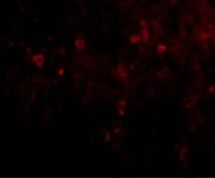 Anti-EBI3 antibody used in IHC (Paraffin sections) (IHC-P). GTX17036