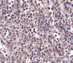 Anti-EBI3 antibody used in IHC (Paraffin sections) (IHC-P). GTX17036