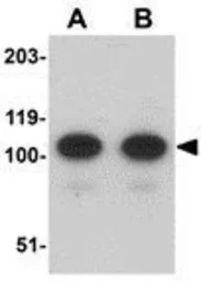 Anti-AFAP1L2 antibody used in Western Blot (WB). GTX17041