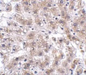 Anti-AFAP1L2 antibody used in IHC (Paraffin sections) (IHC-P). GTX17041