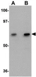 Anti-GALNT10 antibody used in Western Blot (WB). GTX17042