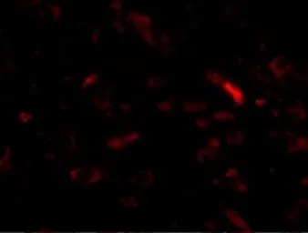 Anti-GALNT10 antibody used in IHC (Paraffin sections) (IHC-P). GTX17042