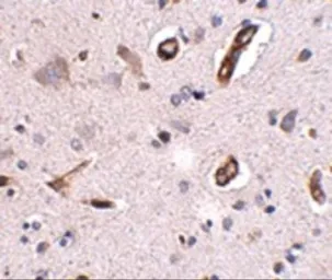 Anti-GALNT10 antibody used in IHC (Paraffin sections) (IHC-P). GTX17042