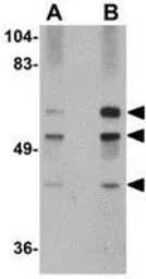 Anti-GALNT10 antibody used in Western Blot (WB). GTX17043
