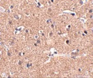 Anti-GALNT10 antibody used in IHC (Paraffin sections) (IHC-P). GTX17043