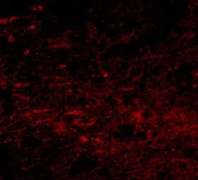 Anti-GALNT10 antibody used in IHC (Paraffin sections) (IHC-P). GTX17043