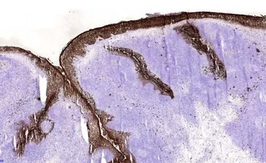 Anti-S100A8 + S100A9 antibody [27E10] used in IHC (Frozen sections) (IHC-Fr). GTX17050