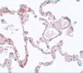 Anti-PLEKHM1 antibody used in IHC (Paraffin sections) (IHC-P). GTX17056