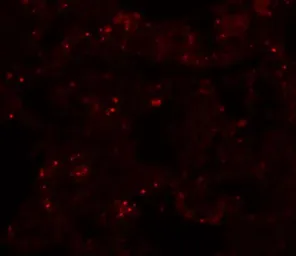 Anti-PLEKHM1 antibody used in IHC (Paraffin sections) (IHC-P). GTX17056