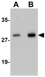 Anti-Synaptogyrin 2 antibody used in Western Blot (WB). GTX17057