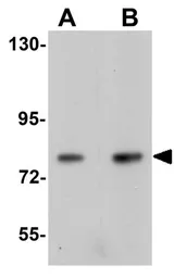 Anti-APC5 antibody used in Western Blot (WB). GTX17060