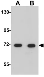 Anti-Apc6 antibody used in Western Blot (WB). GTX17065