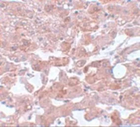 Anti-Apc6 antibody used in IHC (Paraffin sections) (IHC-P). GTX17065