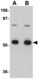 Anti-CDC23 antibody used in Western Blot (WB). GTX17066