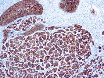 Anti-Cytokeratin 7 antibody [OV-TL 12/30] (ready-to-use) used in IHC (Paraffin sections) (IHC-P). GTX17069