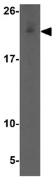 Anti-Apc11 antibody used in Western Blot (WB). GTX17072