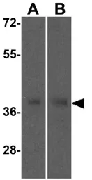 Anti-SIRT4 antibody used in Western Blot (WB). GTX17074