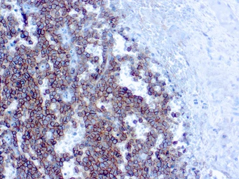 Anti-CD99 antibody [HO36-1.1] used in IHC (Paraffin sections) (IHC-P). GTX17083