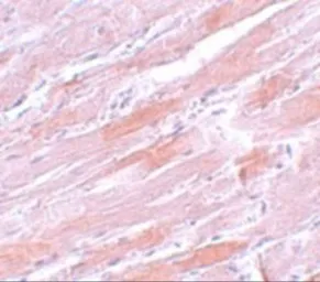 Anti-IDH2 antibody used in IHC (Paraffin sections) (IHC-P). GTX17090
