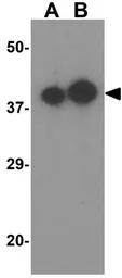 Anti-Apolipoprotein A4 antibody used in Western Blot (WB). GTX17091