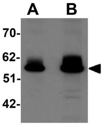 Anti-ZBTB3 antibody used in Western Blot (WB). GTX17095
