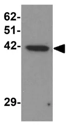 Anti-ZBTB6 antibody used in Western Blot (WB). GTX17096