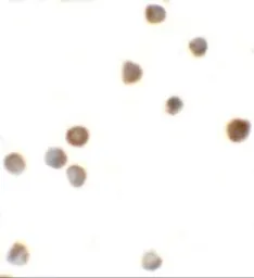 Anti-ZBTB6 antibody used in Immunocytochemistry/ Immunofluorescence (ICC/IF). GTX17096