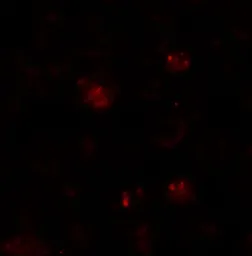 Anti-ZBTB6 antibody used in Immunocytochemistry/ Immunofluorescence (ICC/IF). GTX17096