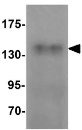 Anti-ZMYM3 antibody used in Western Blot (WB). GTX17097