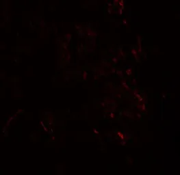 Anti-ZMYM3 antibody used in IHC (Paraffin sections) (IHC-P). GTX17097