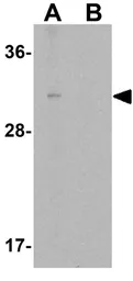 Anti-Nkx3.2 antibody used in Western Blot (WB). GTX17098