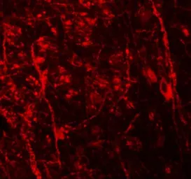 Anti-Nkx3.2 antibody used in IHC (Paraffin sections) (IHC-P). GTX17098
