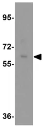 Anti-CTNNBL1 antibody used in Western Blot (WB). GTX17099