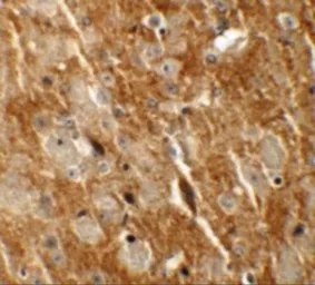 Anti-CTNNBL1 antibody used in IHC (Paraffin sections) (IHC-P). GTX17099