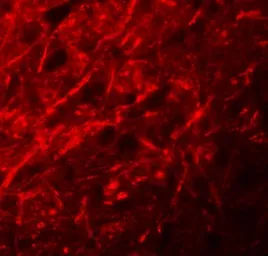 Anti-CTNNBL1 antibody used in IHC (Paraffin sections) (IHC-P). GTX17099