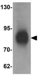 Anti-LRRFIP1 antibody used in Western Blot (WB). GTX17100