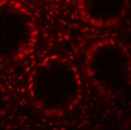 Anti-LRRFIP1 antibody used in IHC (Paraffin sections) (IHC-P). GTX17100