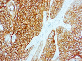 Anti-Cytokeratin 5 + 6 antibody [D5/16 B4] used in IHC (Paraffin sections) (IHC-P). GTX17133
