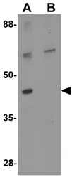 Anti-GEMC1 antibody used in Western Blot (WB). GTX17134