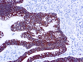 Anti-Cytokeratin 8 + 18 antibody [5D3] used in IHC (Paraffin sections) (IHC-P). GTX17139